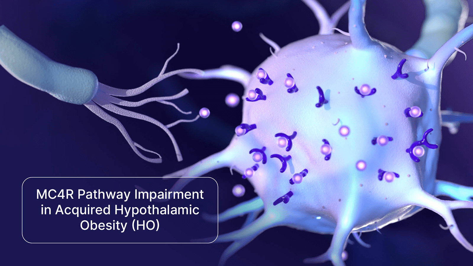 MC4R Pathway Impairment in Aquired Hypothalamic Obesity (HO)