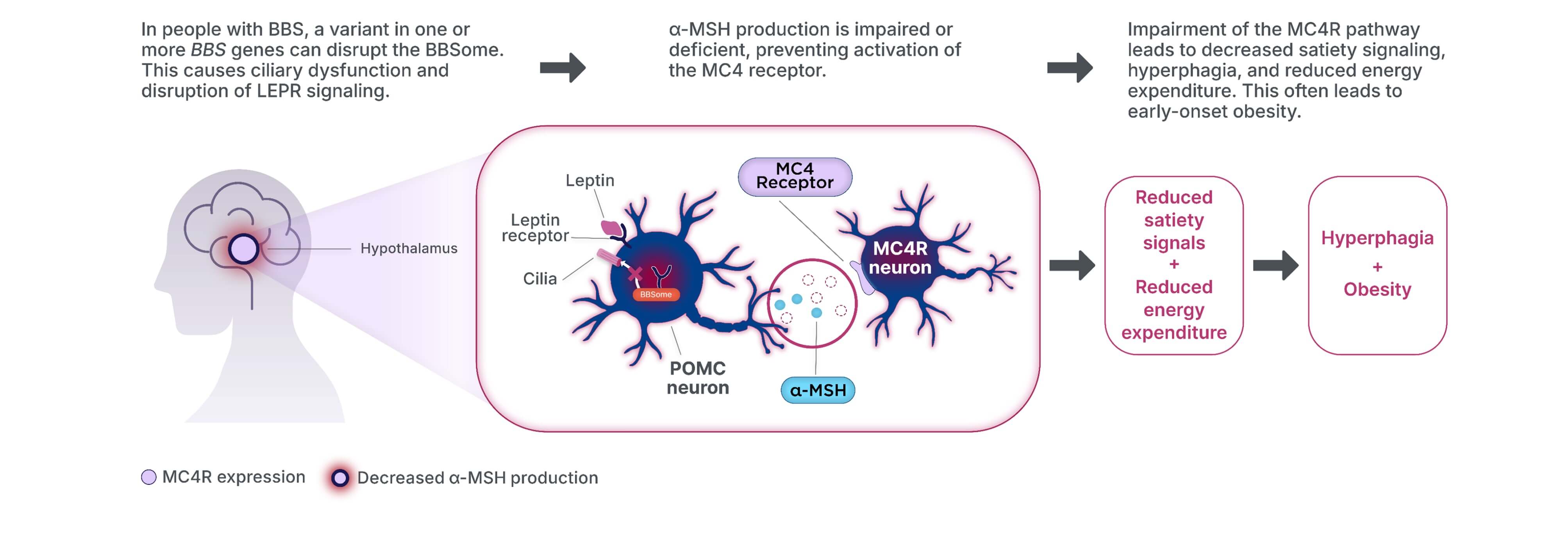 In people with Bardet-Biedl syndrome (BBS), a variant in one or more Bardet-Biedl syndrome (BBS) genes can disrupt the Bardet-Biedl syndrome (BBS)ome, leading to ciliary dysfunction and disruption of LEPR signaling. Alpha-melanocyte-stimulating hormone production is impaired or deficient, which prevents activation of the MC4 receptor and impairment of the MC4R pathway. This leads to decreased satiety signaling, hyperphagia, and reduced energy expenditure, all of which can lead to early-onset obesity.