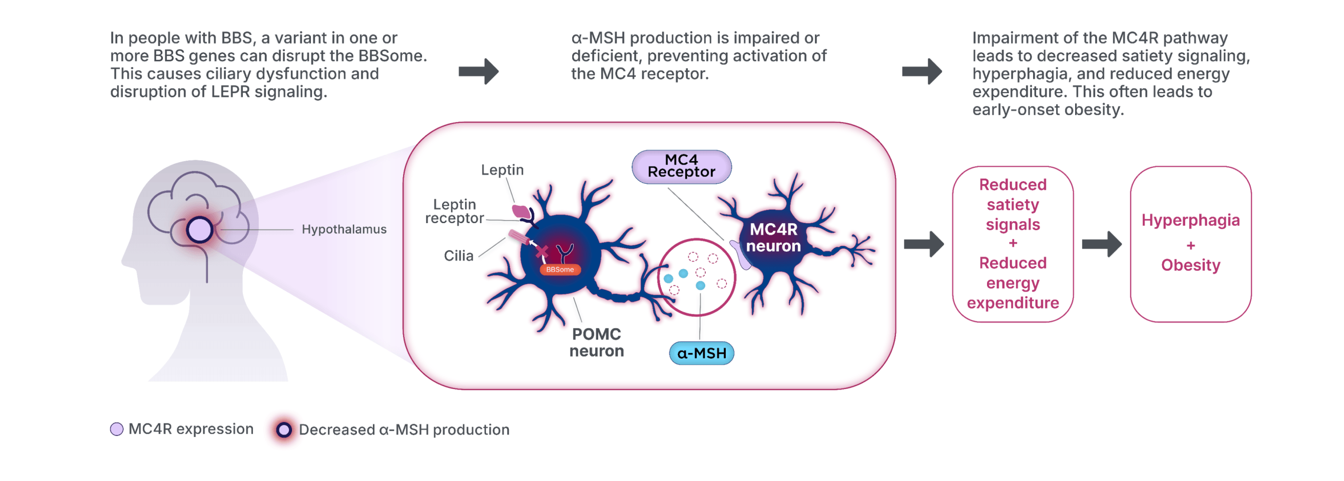 In people with Bardet-Biedl syndrome (BBS), a variant in one or more Bardet-Biedl syndrome (BBS) genes can disrupt the Bardet-Biedl syndrome (BBS)ome, leading to ciliary dysfunction and disruption of LEPR signaling. Alpha-melanocyte-stimulating hormone production is impaired or deficient, which prevents activation of the MC4 receptor and impairment of the MC4R pathway. This leads to decreased satiety signaling, hyperphagia, and reduced energy expenditure, all of which can lead to early-onset obesity.