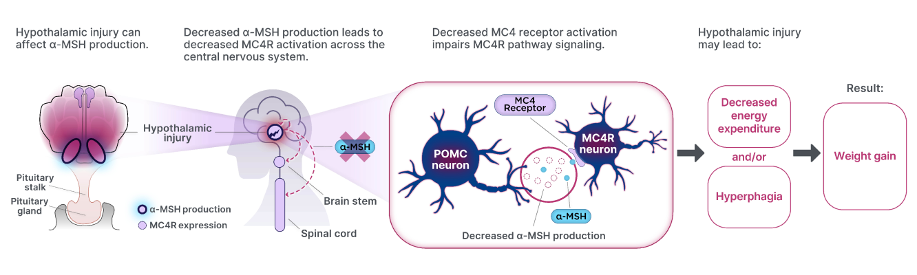 Hypothalamic injury can affect production of alphamelanocyte- stimulating hormone, and this decreased production leads to decreased MC4R activation. This then impairs MC4R pathway signaling, which may lead to hyperphagia and decreased energy expenditure that results in accelerated and sustained weight gain.