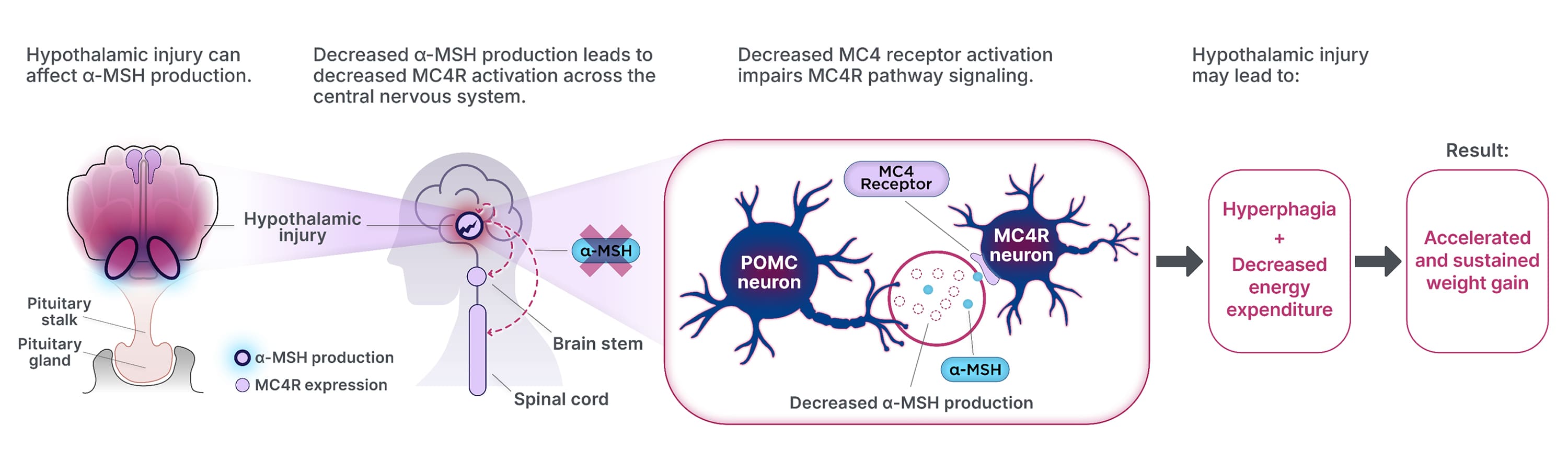Hypothalamic injury can affect production of alphamelanocyte- stimulating hormone, and this decreased production leads to decreased MC4R activation. This then impairs MC4R pathway signaling, which may lead to hyperphagia and decreased energy expenditure that results in accelerated and sustained weight gain.